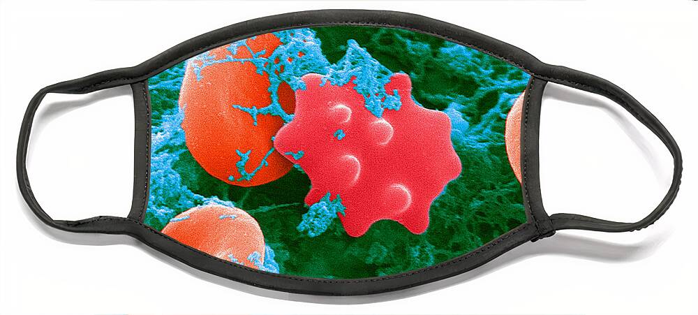 Biology Face Mask featuring the photograph Red Blood Cells And Acanthocyte, Sem #1 by Science Source