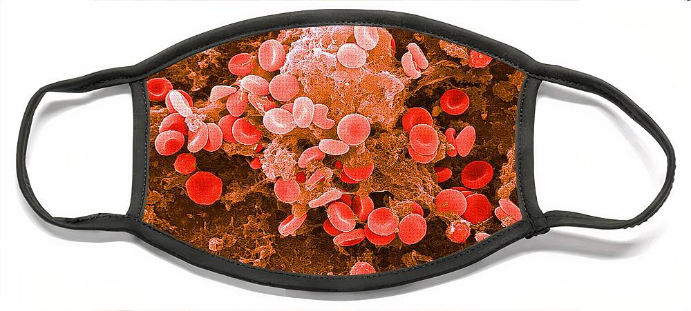 Biology Face Mask featuring the photograph Red Blood Cells, Sem #30 by Science Source