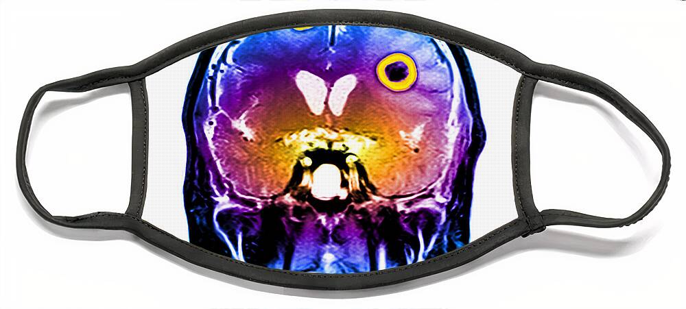 Mri Face Mask featuring the photograph Brain Tumors #7 by Medical Body Scans