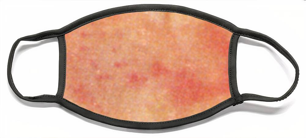 Psoriasis Chest Face Mask featuring the photograph Acute Psoriasis by Science Source