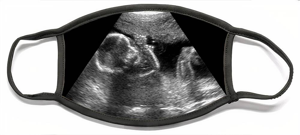 Ultrasound Face Mask featuring the photograph Ultrasound by Medical Body Scans