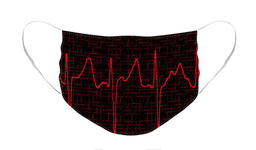 Atrial Fibrillation Face Mask featuring the photograph Atrial Fibrillation #3 by Science Source
