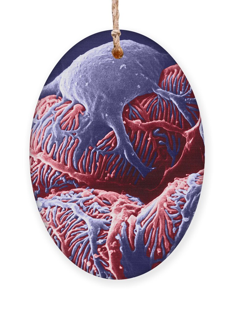 System Ornament featuring the photograph Kidney Glomerulus, Sem by Don W Fawcett