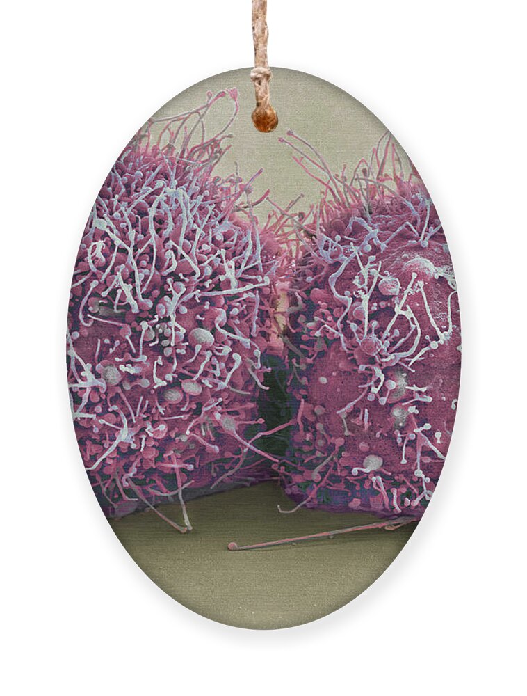 Science Ornament featuring the photograph Dividing Hela Cells, Sem by Science Source