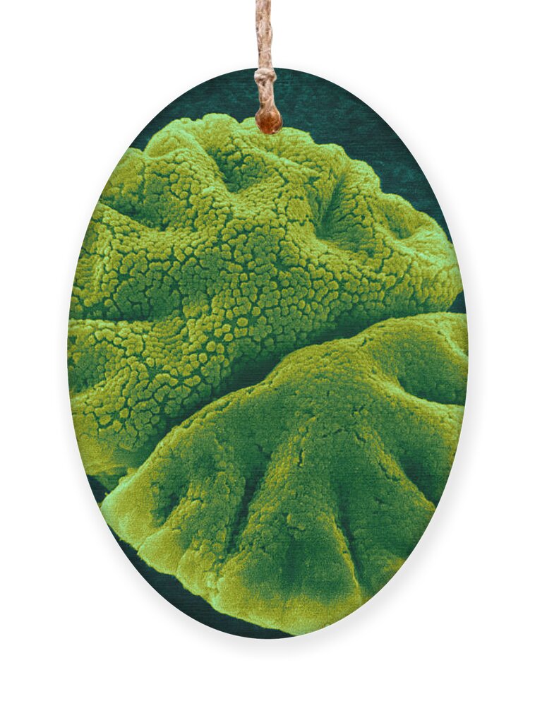 Science Ornament featuring the photograph Micrasterias Angulosa, Algae, Sem by Jerome Pickett-Heaps