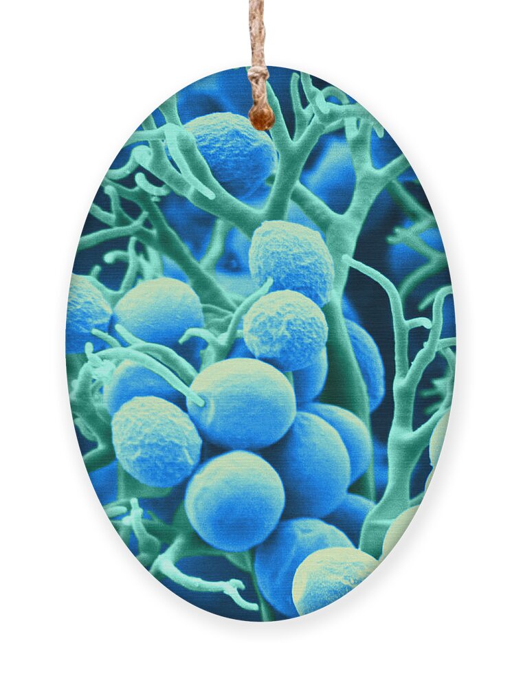 Histology Ornament featuring the photograph Peronospora Parasitica #1 by Biophoto Associates and Photo Researchers