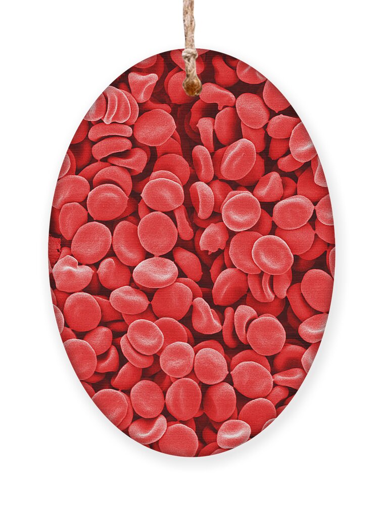 Red Blood Cells Ornament featuring the photograph Red Blood Cells, Sem by Scimat