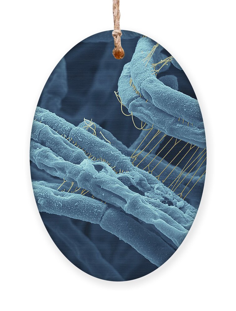 Sem Ornament featuring the photograph Anthrax bacteria SEM by Eye Of Science and Photo Researchers