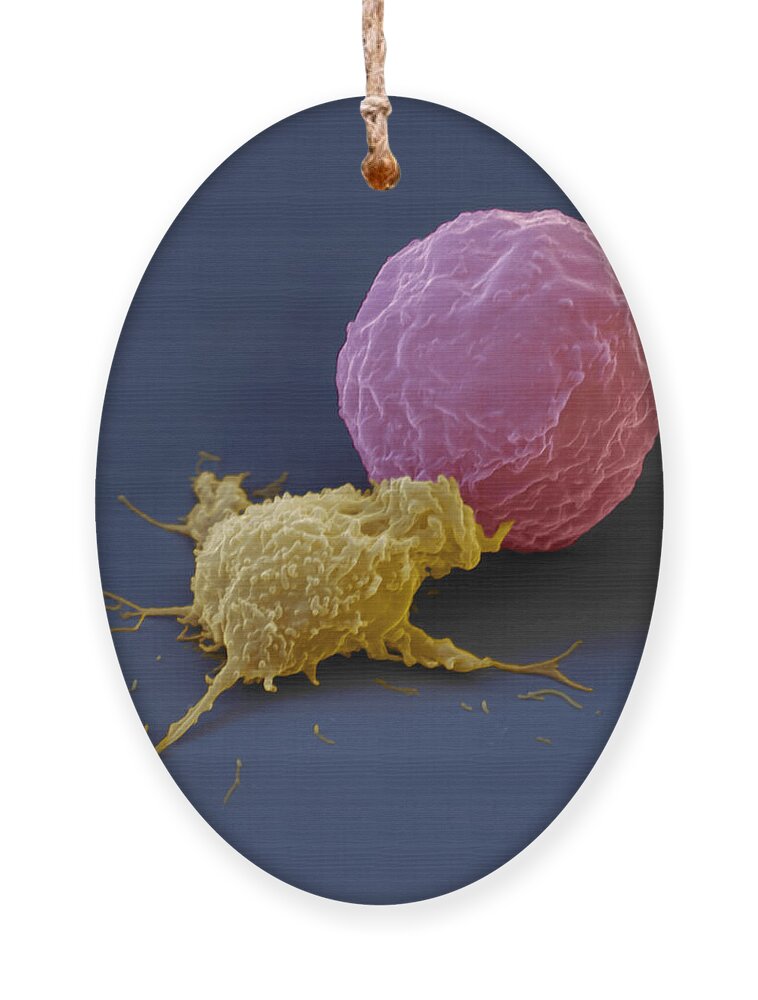 Antigen Ornament featuring the photograph Killer Cell And Cancer Cell by Meckes/ottawa