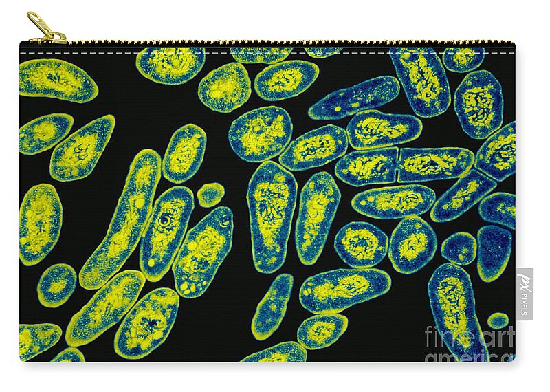Microscopic Zip Pouch featuring the photograph Tem Of Mycobacterium Tuberculosis #1 by Kwangshin Kim