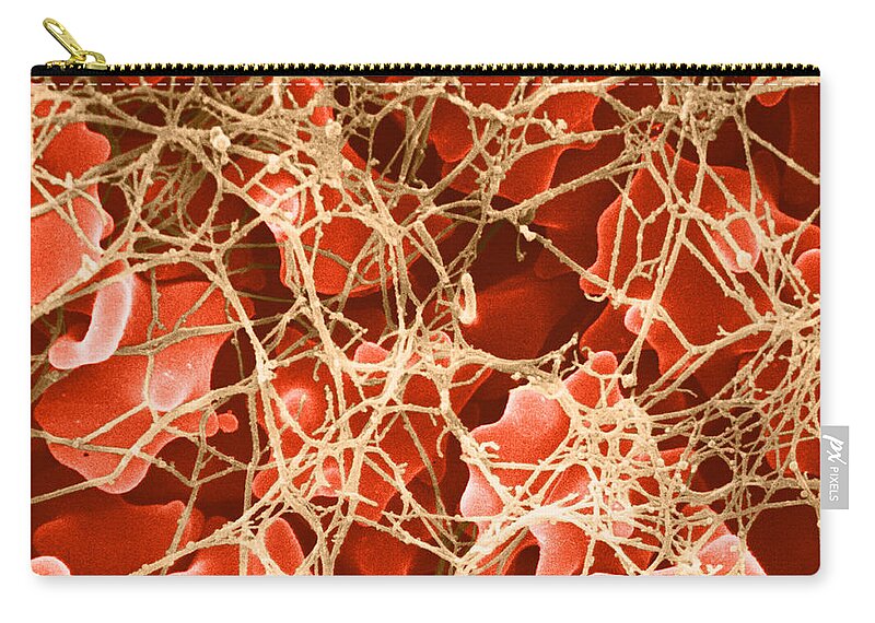 Science Zip Pouch featuring the photograph Blood Clot Sem, 2 Of 3 #2 by David M. Phillips