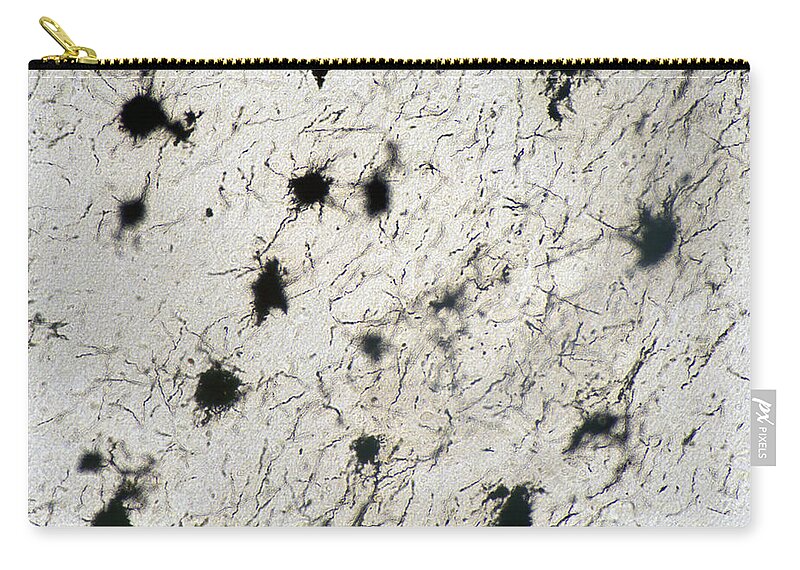 Horizontal Zip Pouch featuring the photograph Cerebrum Neurons, Golgi Stain, Lm #2 by Science Stock Photography