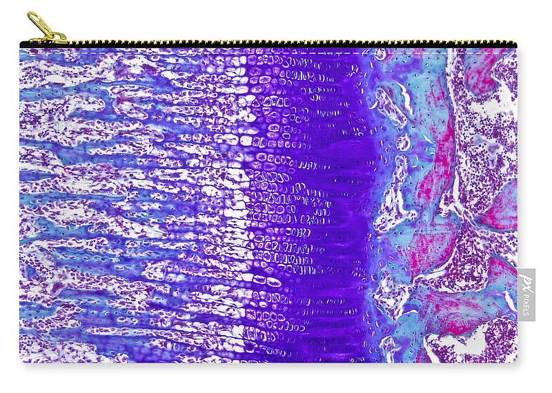 Bone Zip Pouch featuring the photograph Developing Bone Lm #1 by Alvin Telser