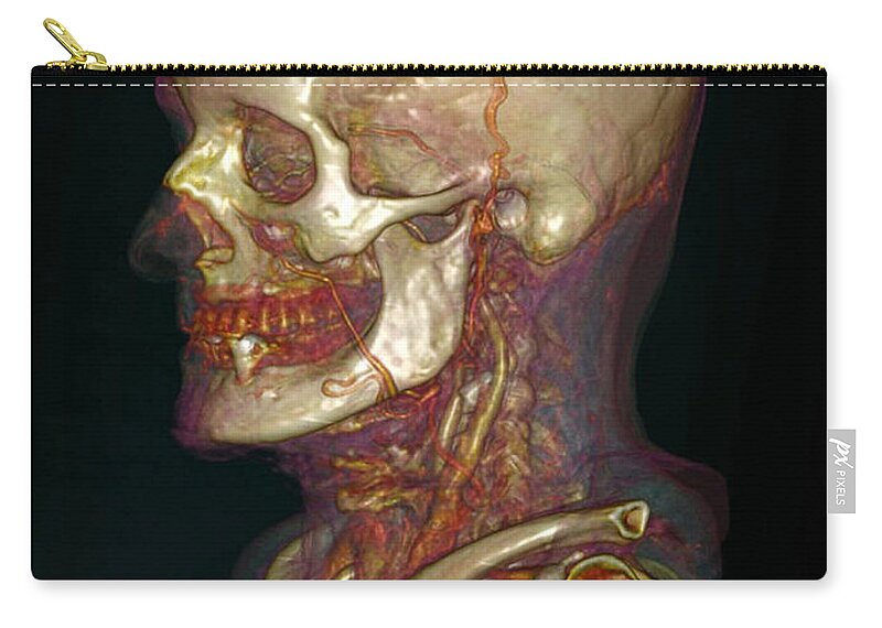 Angiography Zip Pouch featuring the photograph Male Skull & Arterial System #2 by Scott Camazine