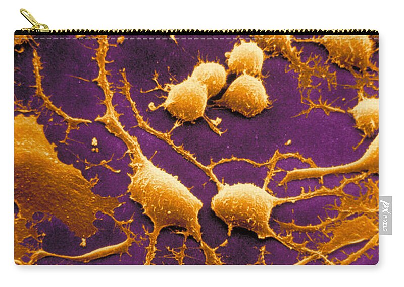 Dendrites Zip Pouch featuring the photograph Dendrites #3 by David M. Phillips / The Population Council