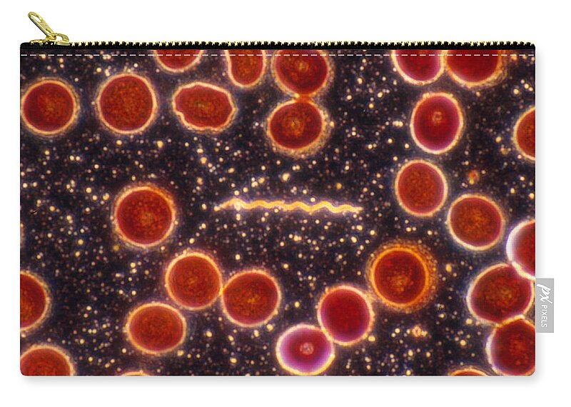 Bacteria Carry-all Pouch featuring the photograph Borrelia Burgdorferi, Lm by Michael Abbey