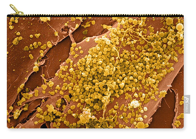 Cell Zip Pouch featuring the photograph Human Skin Cell Sem by David M. Phillips