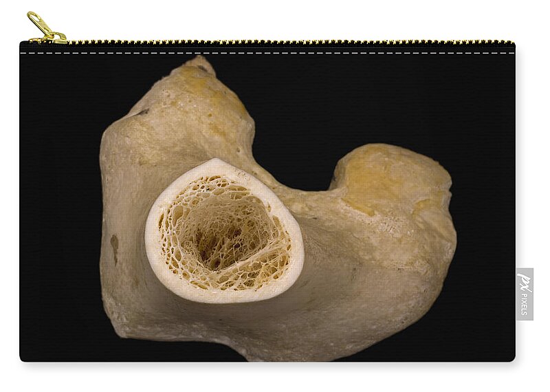 Bone Cross Section Lm Carry All Pouch For Sale By Science Stock Photography