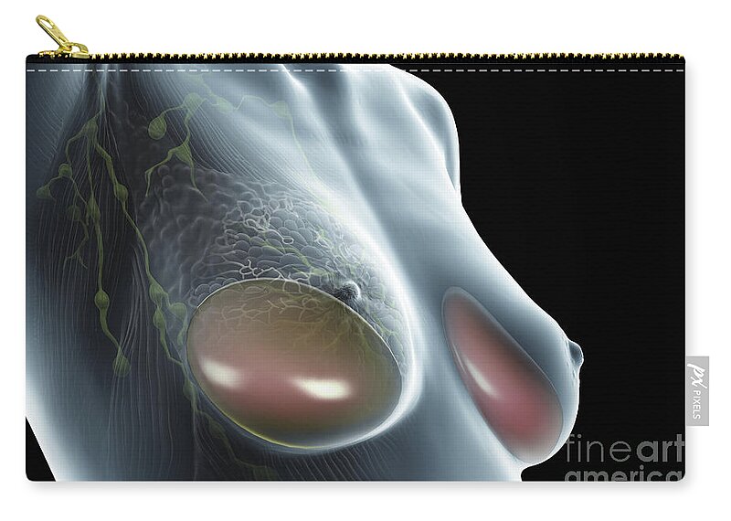 Transparent Zip Pouch featuring the photograph Breast Implants by Science Picture Co