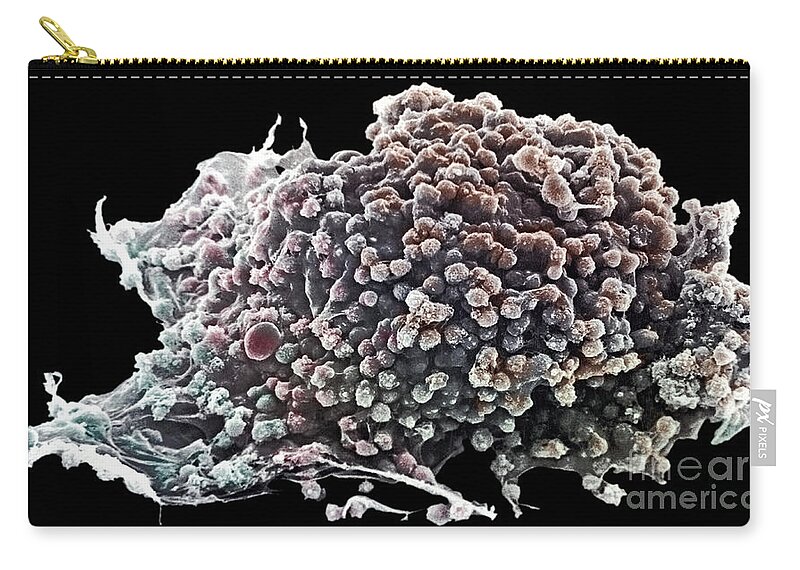 Cancer Zip Pouch featuring the photograph Cancer Cell by David M Phillips