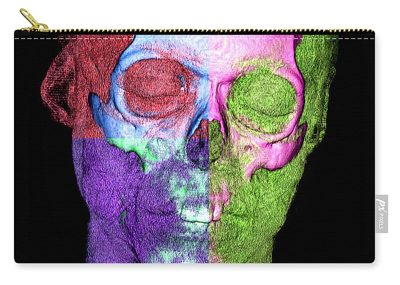 Science Zip Pouch featuring the photograph Enhanced 3d Ct Of Face And Skull by Living Art Enterprises