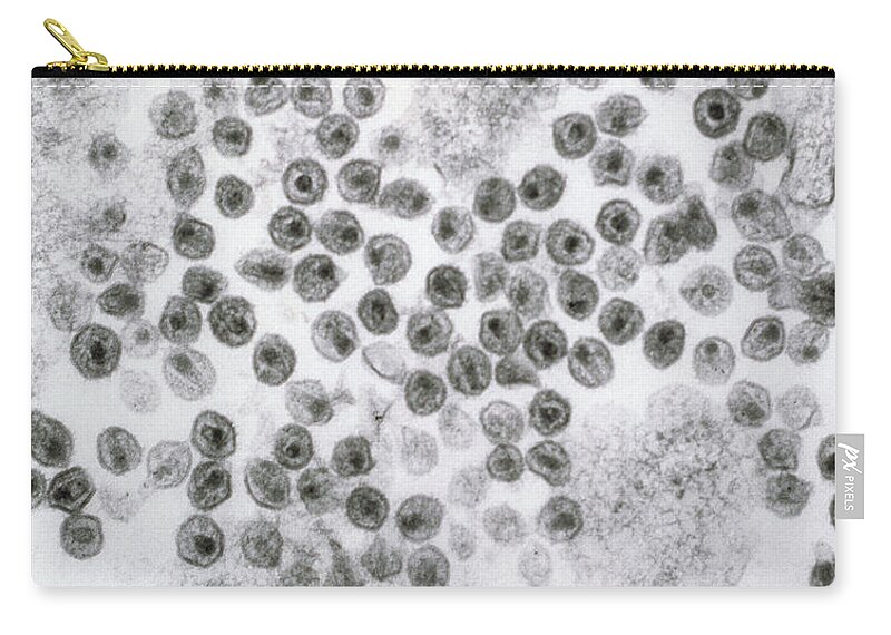 Hiv Carry-all Pouch featuring the photograph Hiv Virus by David M. Phillips