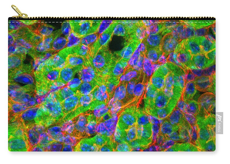 Light Micrograph Zip Pouch featuring the photograph Light Micrograph Of Kidney Tissue by Lauren Piedmont