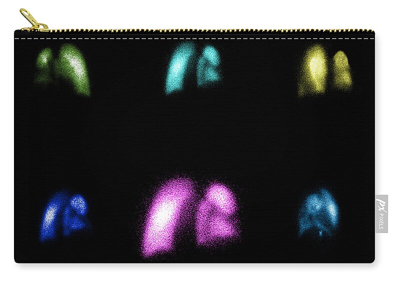 Nuclear Lung Scan Zip Pouch featuring the photograph Nuclear Medicine Lung Scan by Living Art Enterprises, LLC