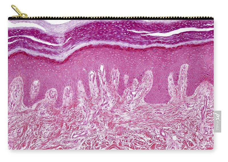 Skin Zip Pouch featuring the photograph Plantar Skin, Lm by Alvin Telser