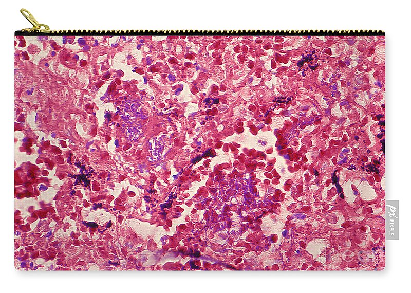 Science Zip Pouch featuring the photograph Bacillus Anthracis, Lm #1 by Science Source