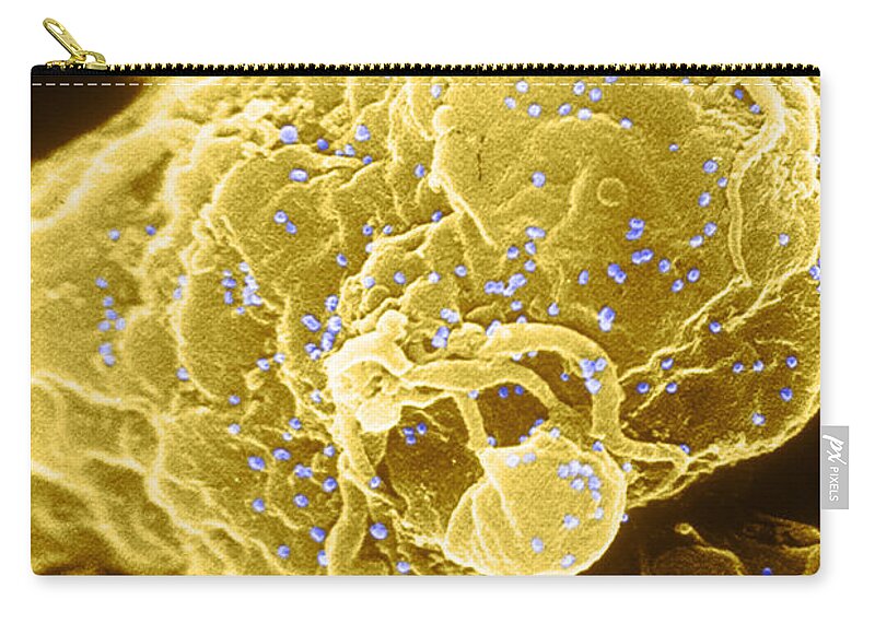 Medical Zip Pouch featuring the photograph Hiv-1 Infected T4 Lymphocyte Sem #1 by Science Source
