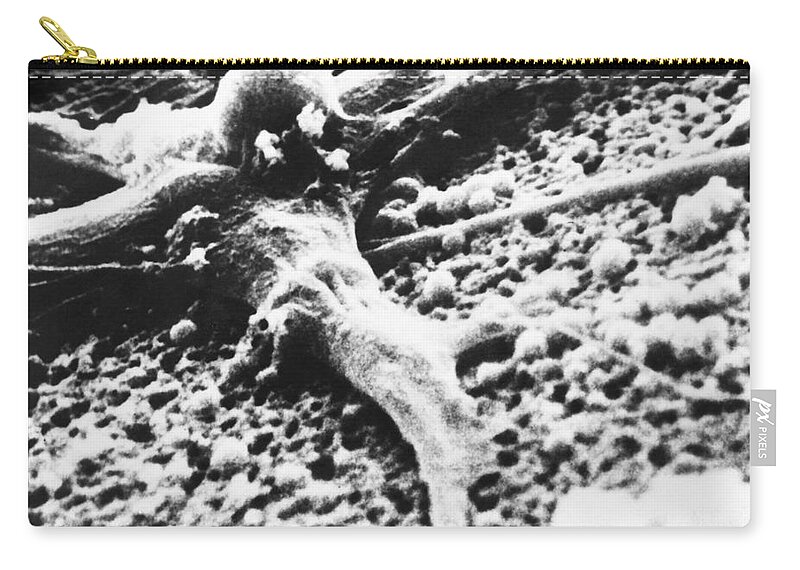 Cancer Zip Pouch featuring the photograph Malignant Cancer Cell #1 by Omikron