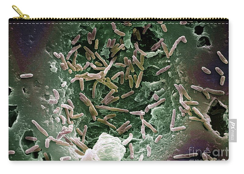 Bacteria Zip Pouch featuring the photograph Mycobacterium Chelonae #1 by Science Source