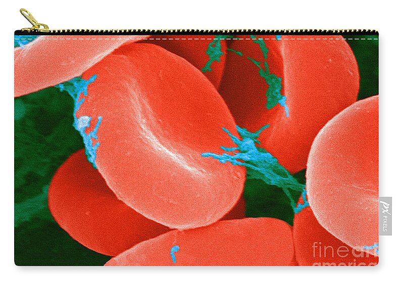 Biology Zip Pouch featuring the photograph Red Blood Cells Sem #5 by Science Source