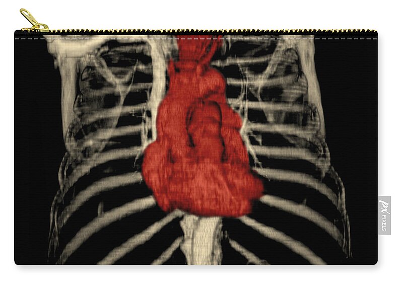 Ct Of Chest Zip Pouch featuring the photograph 3d Ct Reconstruction Of Heart by Medical Body Scans