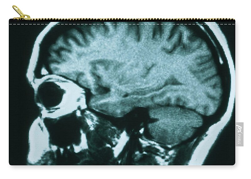 Brain Zip Pouch featuring the photograph Mri Of Normal Brain #4 by Science Source