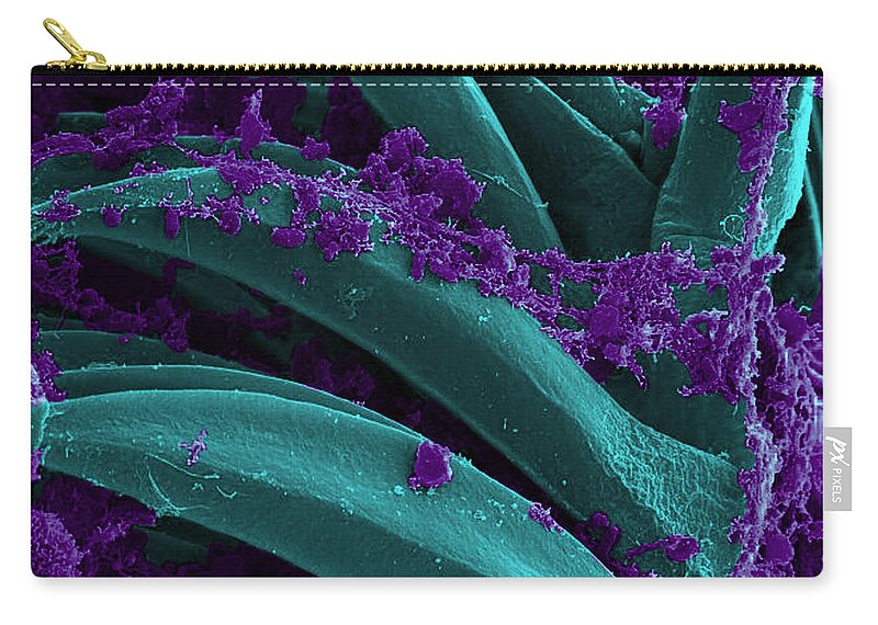Microbiology Zip Pouch featuring the photograph Yersinia Pestis Bacteria, Sem #5 by Science Source