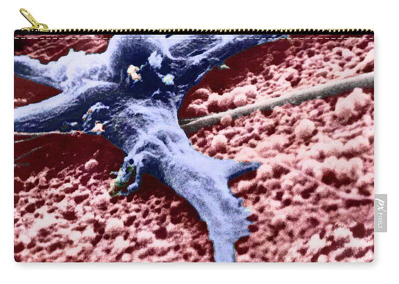Cancer Zip Pouch featuring the photograph Malignant Cancer Cell #8 by Omikron