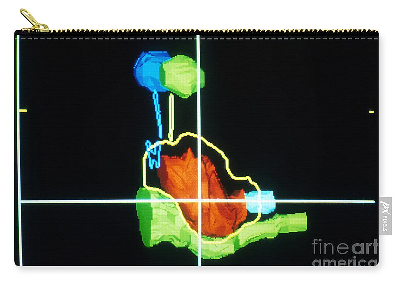 Proton Beam Zip Pouch featuring the photograph Proton Beam From Brain During Ct Scan by Science Source