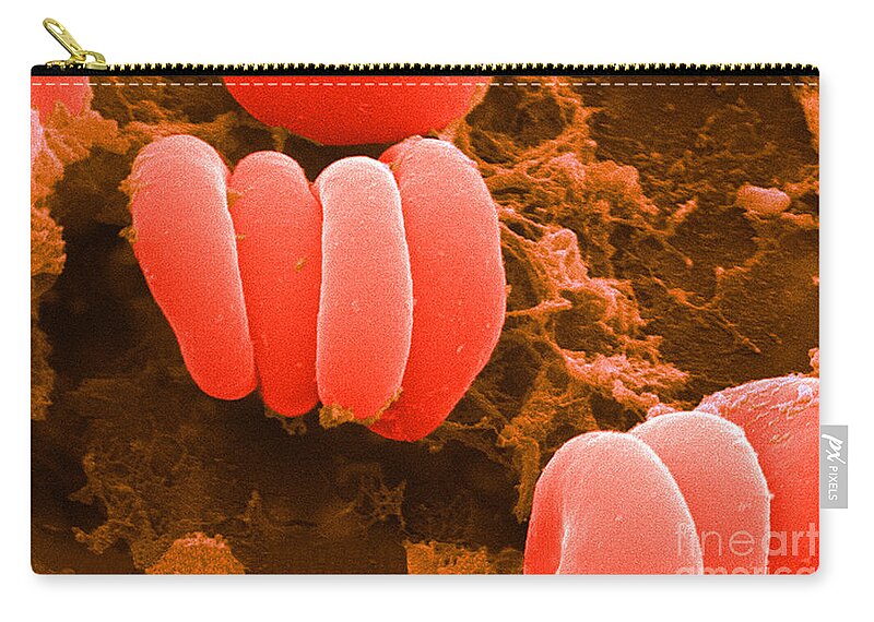 Biology Zip Pouch featuring the photograph Red Blood Cells, Rouleaux Formation, Sem by Science Source