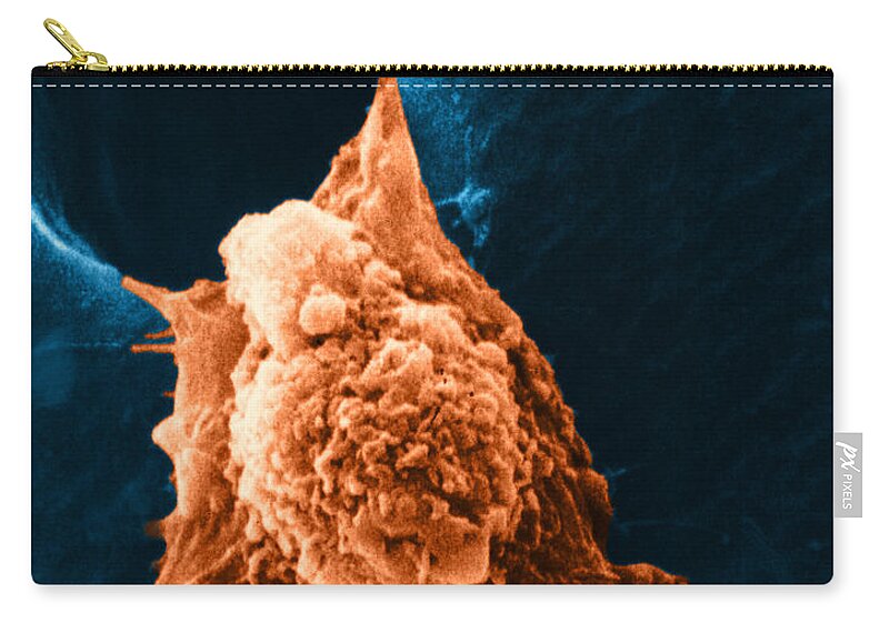 Sem Zip Pouch featuring the photograph Metastasis #3 by Science Source
