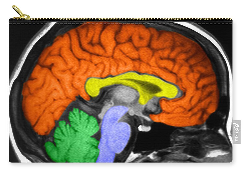 Medical Zip Pouch featuring the photograph Human Brain #10 by Ted Kinsman