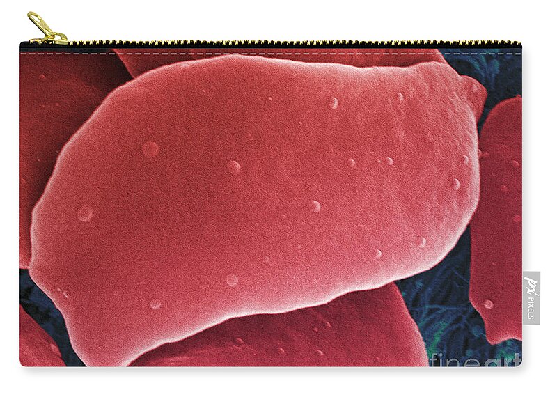 Science Zip Pouch featuring the photograph Blood Platelets, Sem #2 by Ted Kinsman