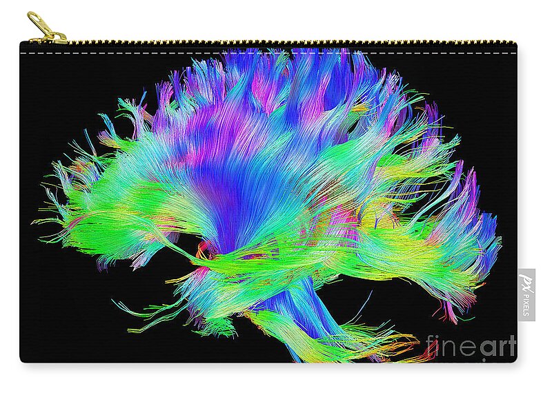 Brain Mri Carry-all Pouch featuring the photograph Fiber Tracts Of The Brain, Dti by Living Art Enterprises