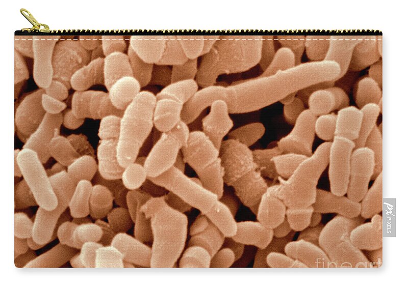 Propionibacterium Acnes Zip Pouch featuring the photograph Propionibacterium Acnes Bacteria, Sem #2 by Scimat