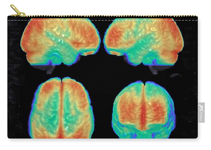 Science Carry-all Pouch featuring the photograph Bipolar Brain, 3d Mri Scan by Science Source