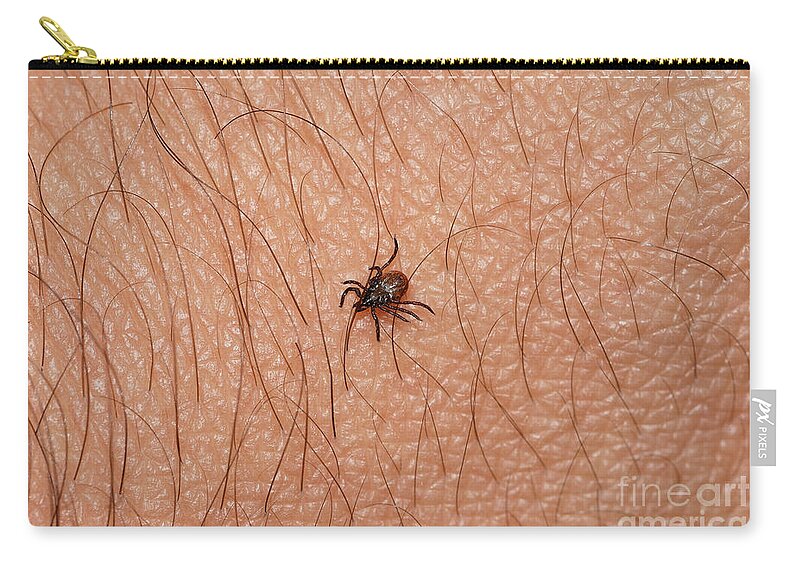 Animal Zip Pouch featuring the photograph Blacklegged Tick by John Kaprielian