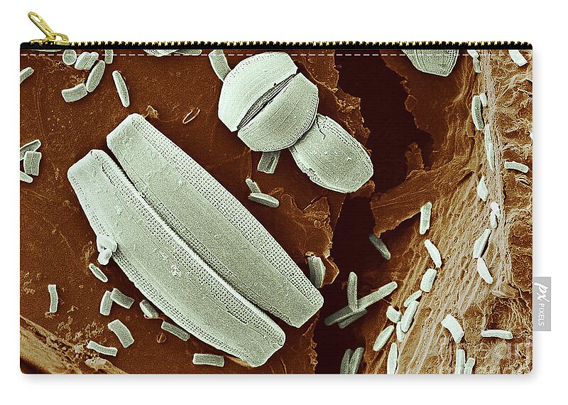 Diatom Zip Pouch featuring the photograph Diatoms Under Natural Conditions by Scimat