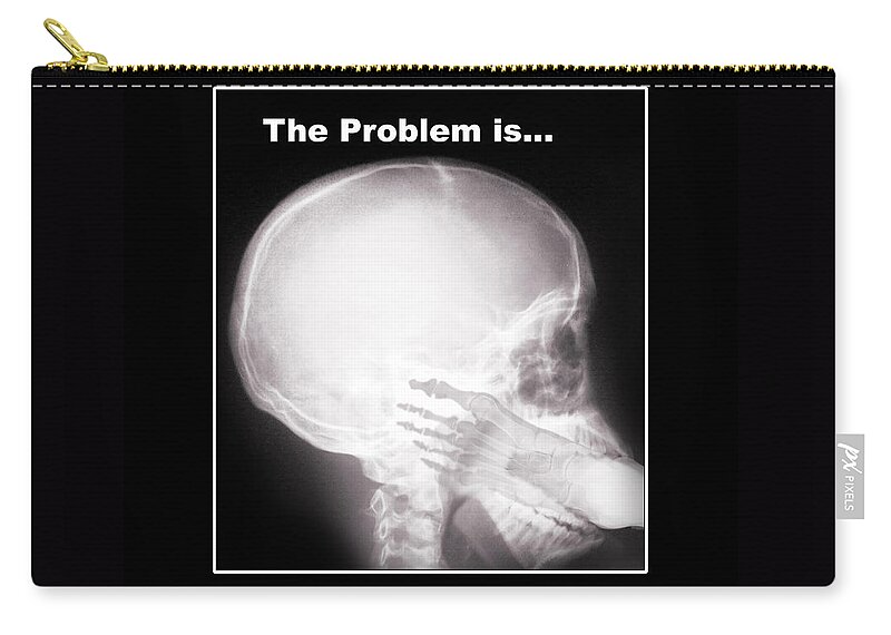 X-ray Zip Pouch featuring the photograph I See the Problem by Gravityx9 Designs