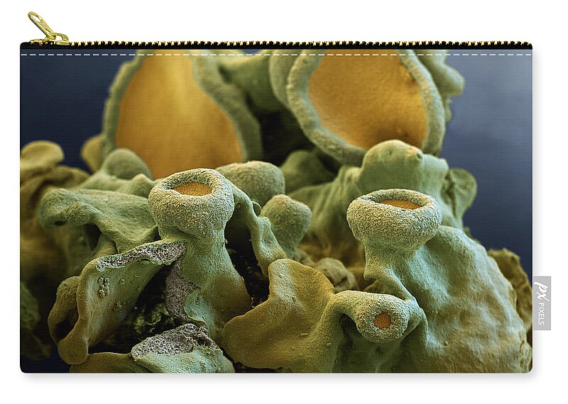 Algae Zip Pouch featuring the photograph Common Orange Lichen by Meckes/ottawa